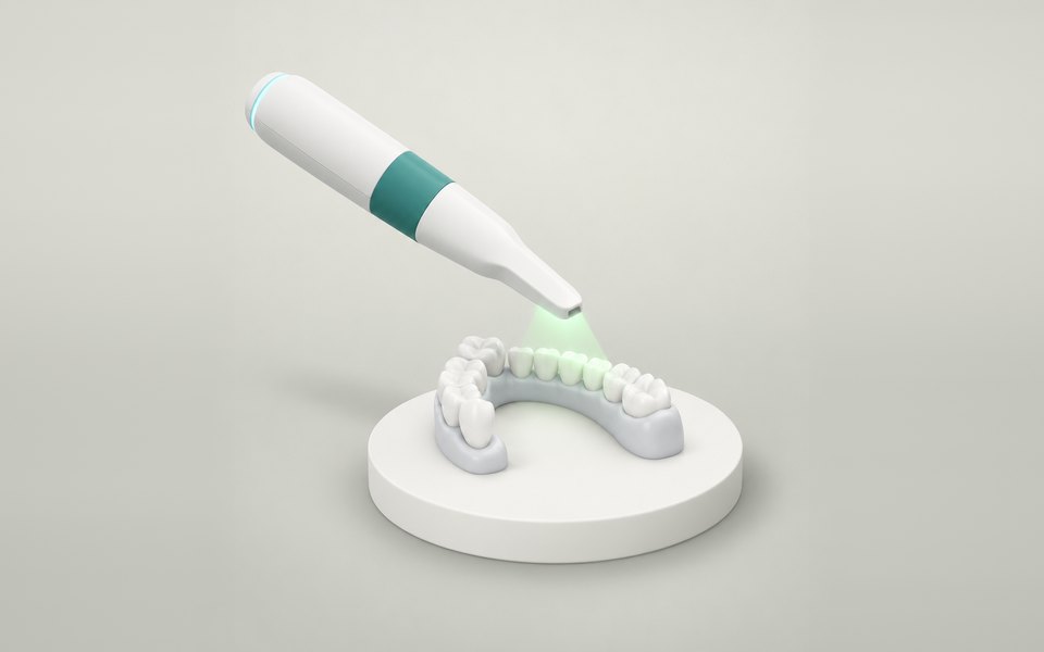 Scanner intraoral fazendo a moldagem digital de um modelo de arcada dentária